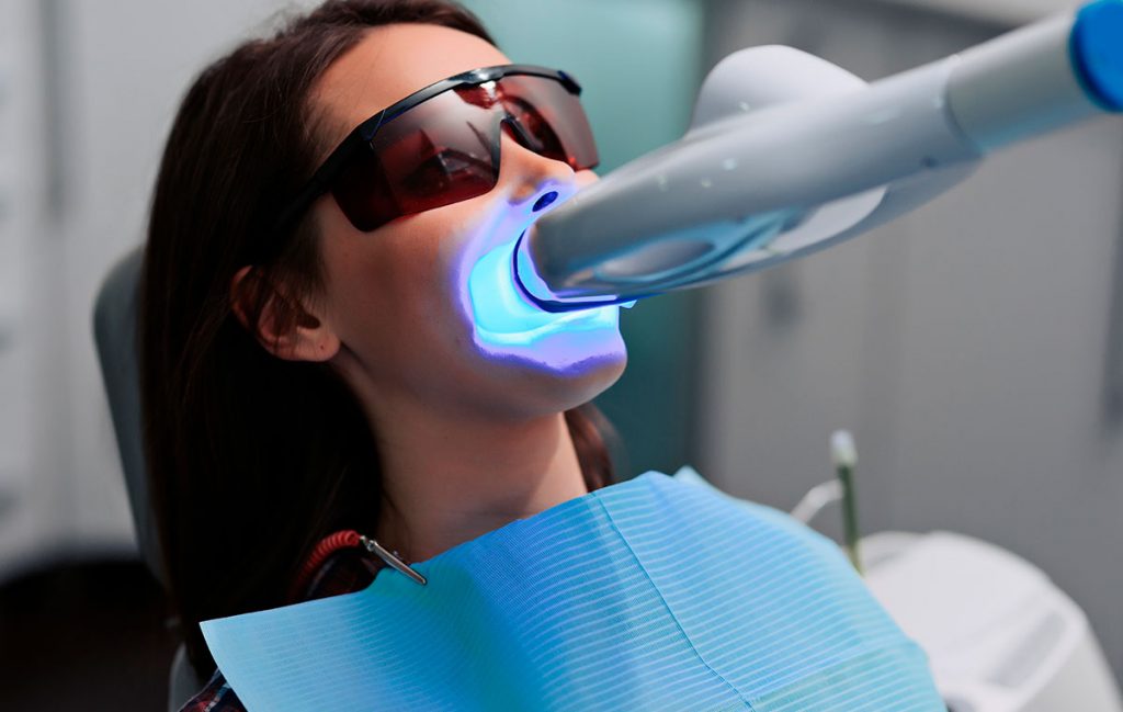 novo clareamento dental a laser valor 2021 tendência