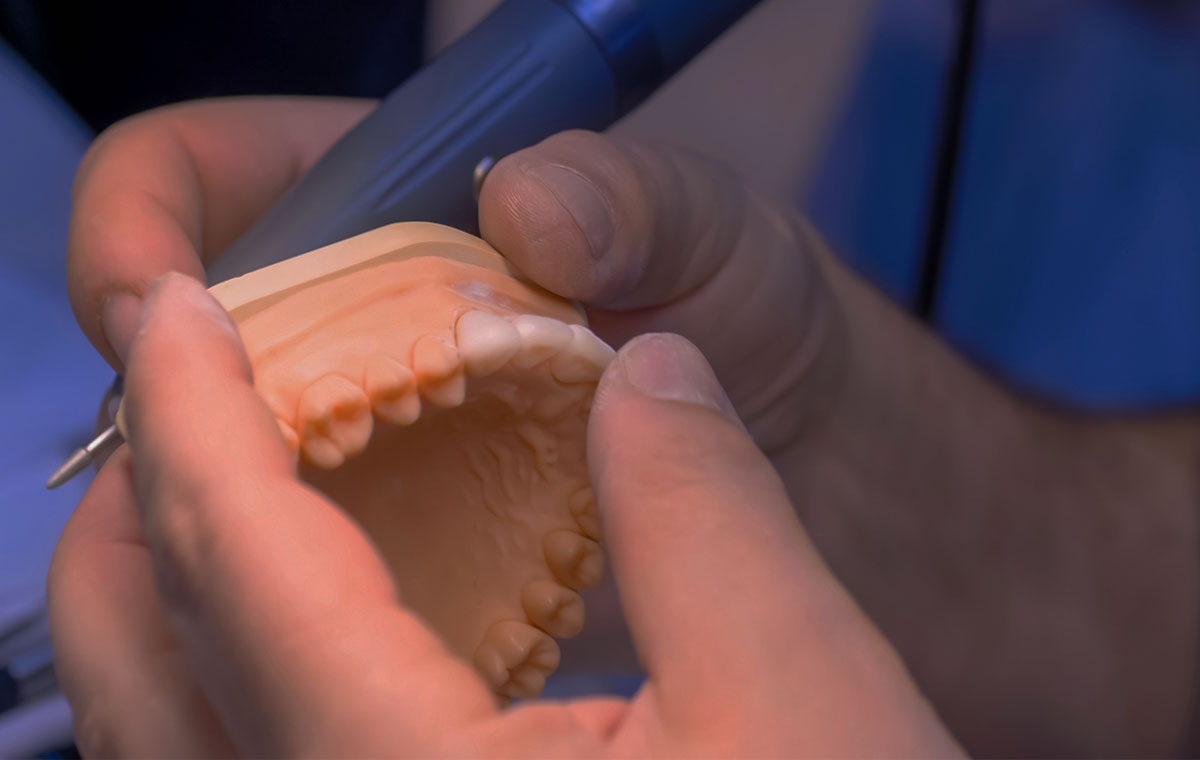 prótese dentária fixa