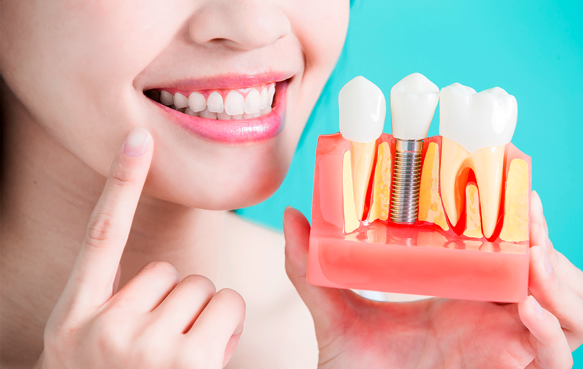 implantar um dente