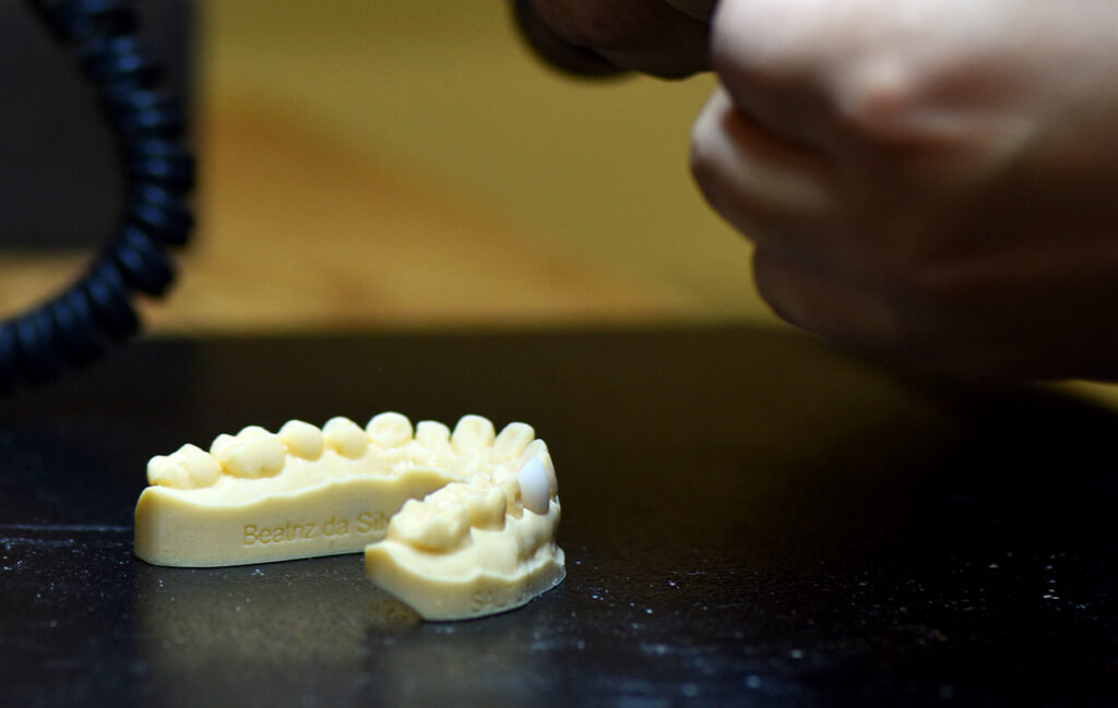 lente de contato dental goiânia